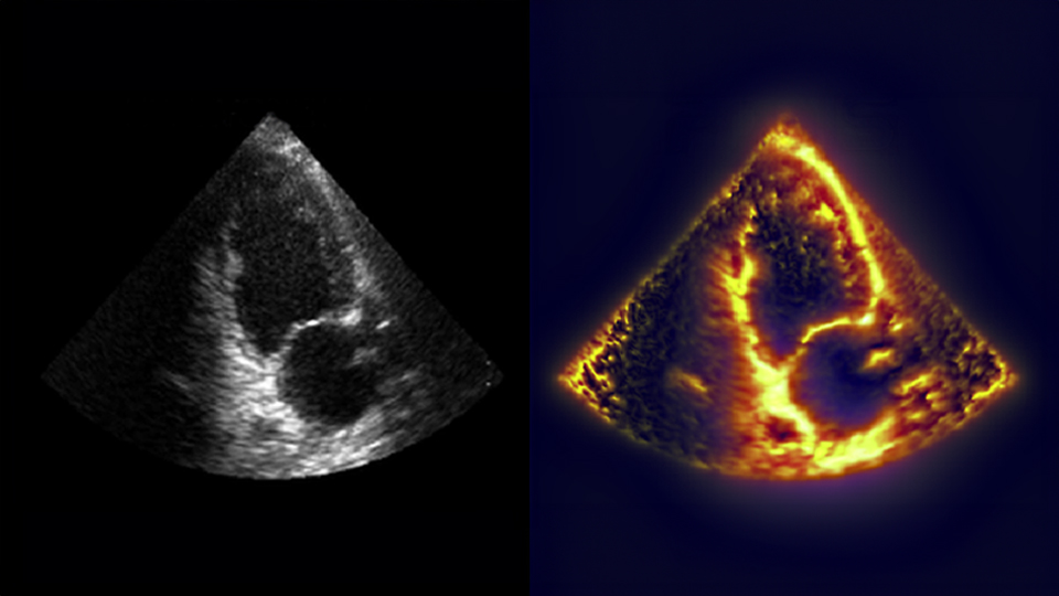 liver-scan-pons-71322.jpg